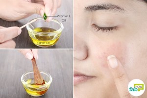 use vitamin e and olive oil to get rid of hyperpigmentation